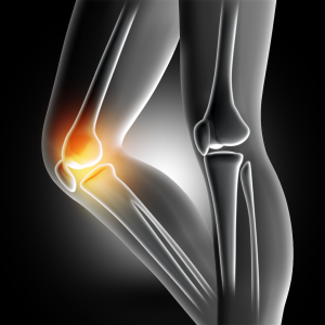 香港中醫推介 港島刮痧 港島銅鑼灣中醫 港島中醫收費 寶運中醫 港島中醫膝關節痛