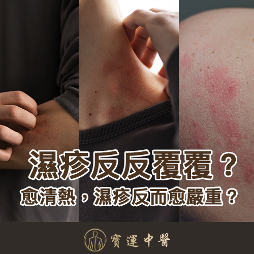 濕疹 濕疹根治 寒濕型濕疹 濕熱型濕疹 濕疹忌口 濕疹止癢 濕疹反覆發作 濕疹中醫 清熱祛濕 溫陽散寒 濕疹保濕 涼茶濕疹 濕疹體質 三伏天灸濕疹 濕疹針灸